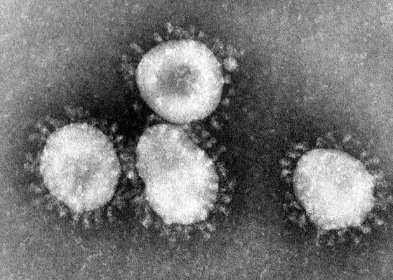 Coronavirus: in Italia stimati circa 35.000 decessi 