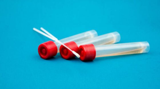 Coronavirus in Toscana: 193 nuovi casi e 9 decessi