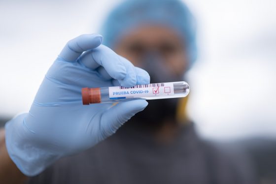 Coronavirus: individuato un cluster familiare a Lucca