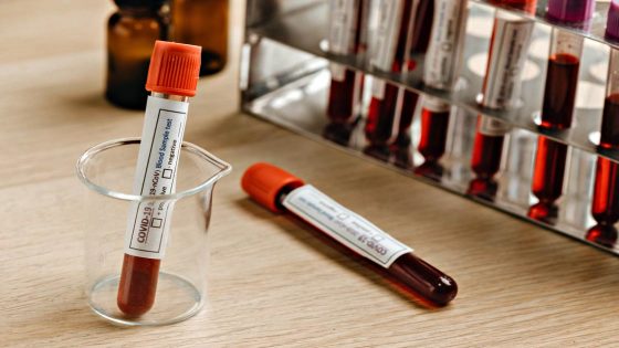 Coronavirus, 908 nuovi casi, età media 48 anni. 38 decessi
