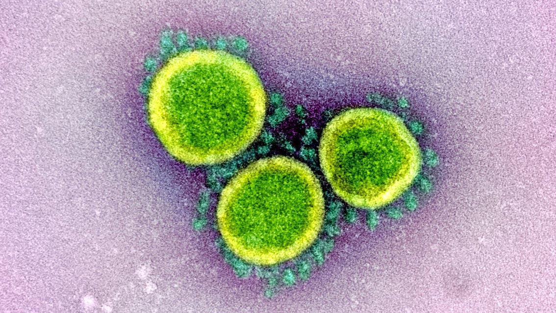 Coronavirus