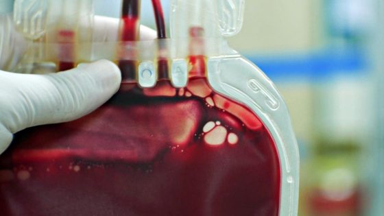 Carenza sangue, le Avis della Toscana al lavoro per intensificare la chiamata dei donatori