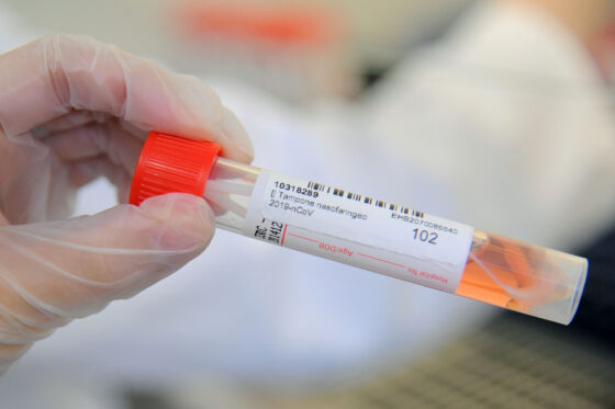 Coronavirus, altri 2.433 nuovi casi e le persone al momento contagiate superano 53 mila