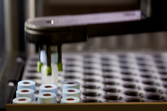 Covid: Tls, partiti test clinici anticorpi monoclonali