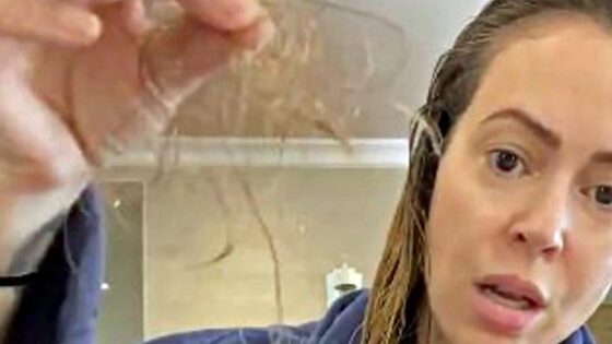 Caduta dei capelli a causa del Coronavirus? Sì ma…