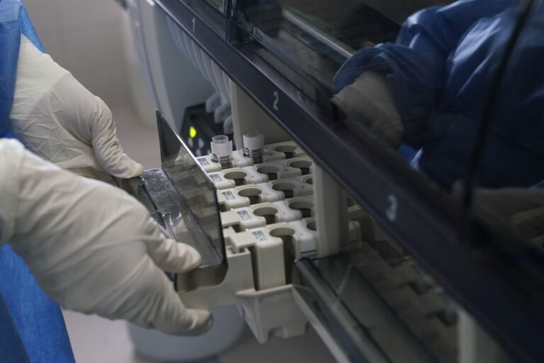 coronavirus liste di attesa