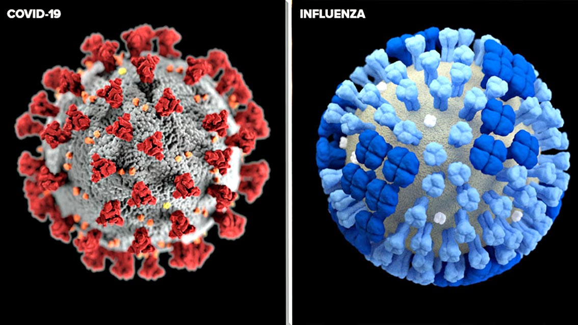 influenza