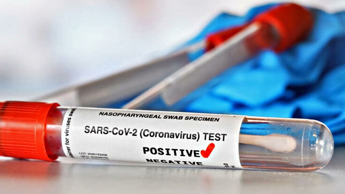 coronavirus