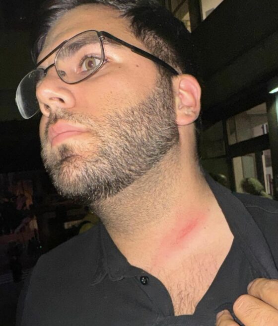 Capogruppo Lega a Massa, “mi ha aggredito un esponente del Pd”