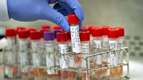 Coronavirus in Toscana, 80 nuovi casi, 2 decessi
