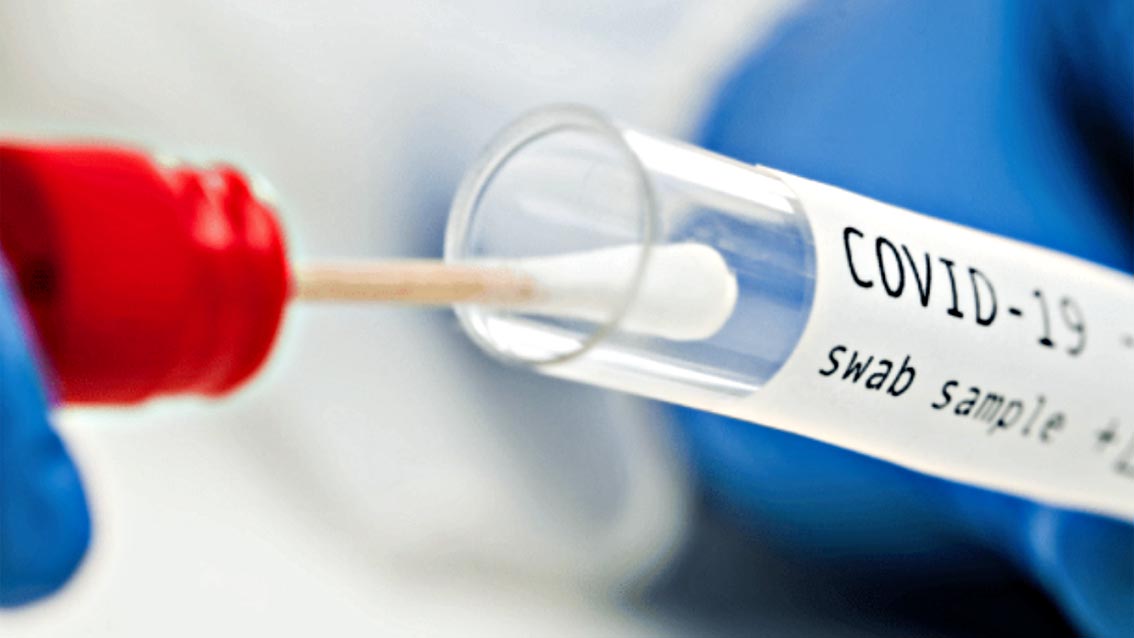 Coronavirus
