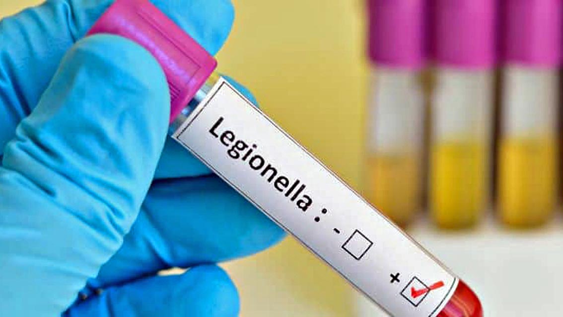 Esiguo aumento di casi di Legionella nell’Aretino. Asl: “Verifiche nell’aquedotto della città in corso”